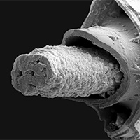 Siphuncle soft-parts in the Upper Jurassic ammonite <i>Kachpurites fulgens</i>.